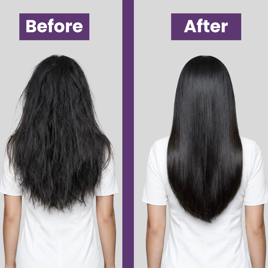 Foligrow Hair Growth Oil